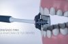 Balene Cepillo de Dientes -  El único cepillo del mundo que limpia la cara interna y externa de los dientes a la vez. Limpia todas las superficies a la vez y elimina toda la placa cuidando de tus encías, esmalte y dientes sensibles.