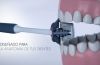  -  El único cepillo del mundo que limpia la cara interna y externa de los dientes a la vez. Limpia todas las superficies a la vez y elimina toda la placa cuidando de tus encías, esmalte y dientes sensibles.