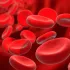 Anemia