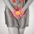 Cistitis