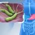 Helicobacter pylori