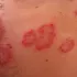 Hongos 